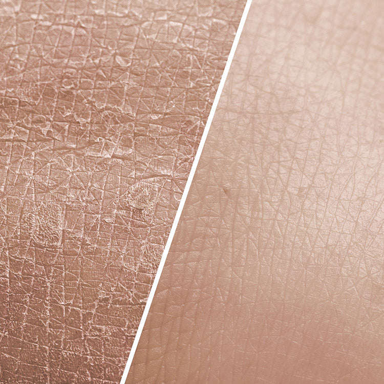 Siff Dry Skin billede 3